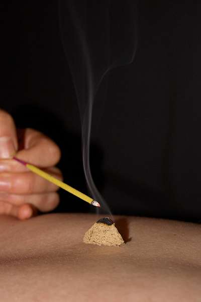 Moxibustion