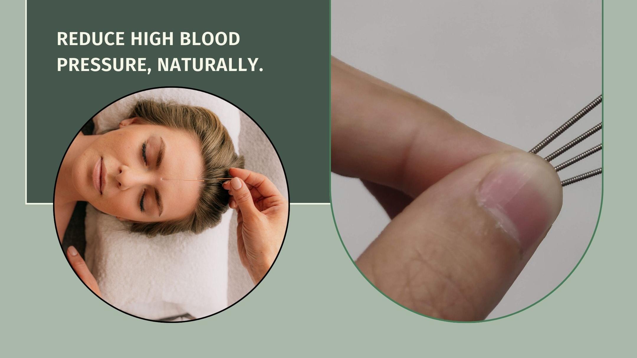 Acupuncture for Hypertension