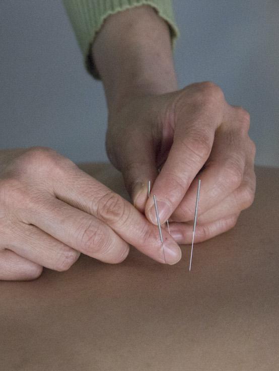 Mika Japanese Acupuncture 4