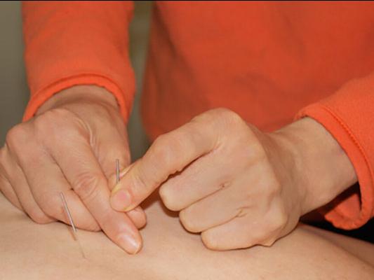 5 Unique Aspects of Japanese Acupuncture: My Lineage